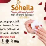 کاشت و ترمیم ناخن سهیلا