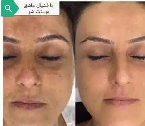 فشیال (پاکسازی) آسمان