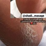 مرکز ماساژ درمانی شادی