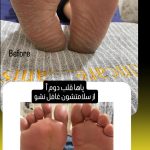 خدمات پاکسازی،فیشال،ماساژ و پدیکور انیس پوررضائی