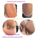 خدمات پاکسازی،فیشال،ماساژ و پدیکور انیس پوررضائی