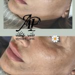 خدمات پاکسازی،فیشال،ماساژ و پدیکور انیس پوررضائی