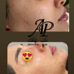 خدمات پاکسازی،فیشال،ماساژ و پدیکور انیس پوررضائی