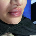 مشاوره رایگان زیبایی رضایی