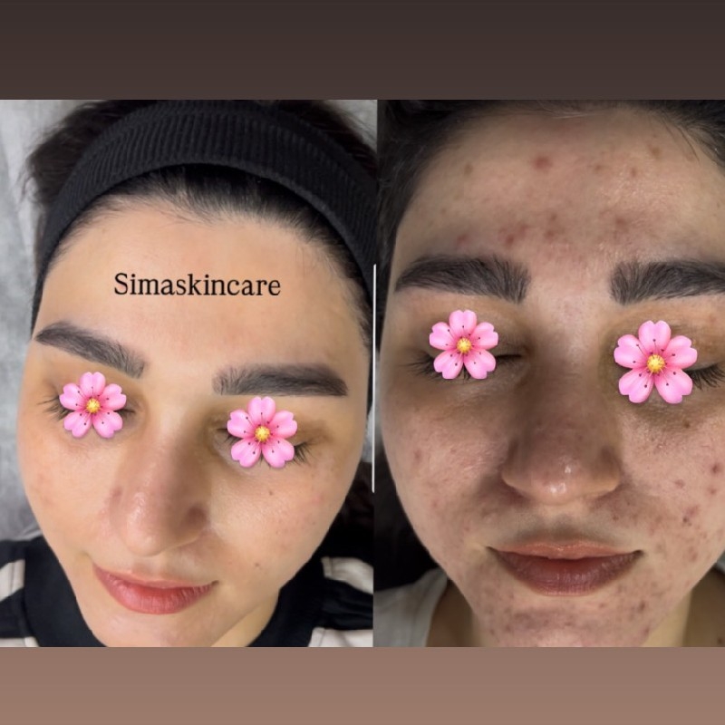 مرکز تخصصی پوست خانه ی امید