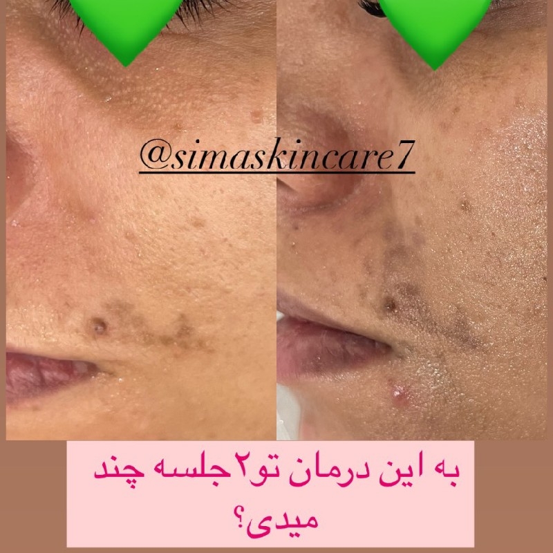 مرکز تخصصی پوست خانه ی امید