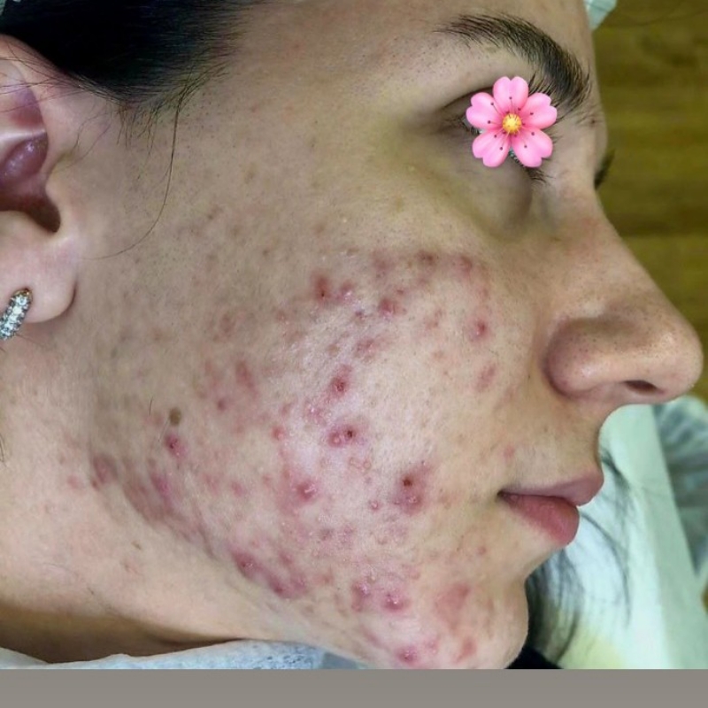 مرکز تخصصی پوست خانه ی امید