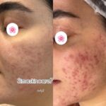 مرکز تخصصی پوست خانه ی امید