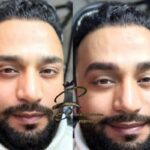 تتو بدن، میکرو بلیدینگ