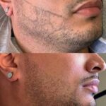 تتو بدن، میکرو بلیدینگ