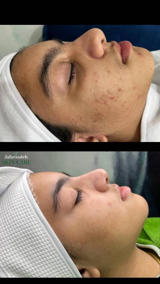 آموزش و خدمات تخصصی پوست خواهران جعفرزاده